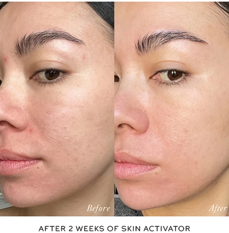 Activator Duo