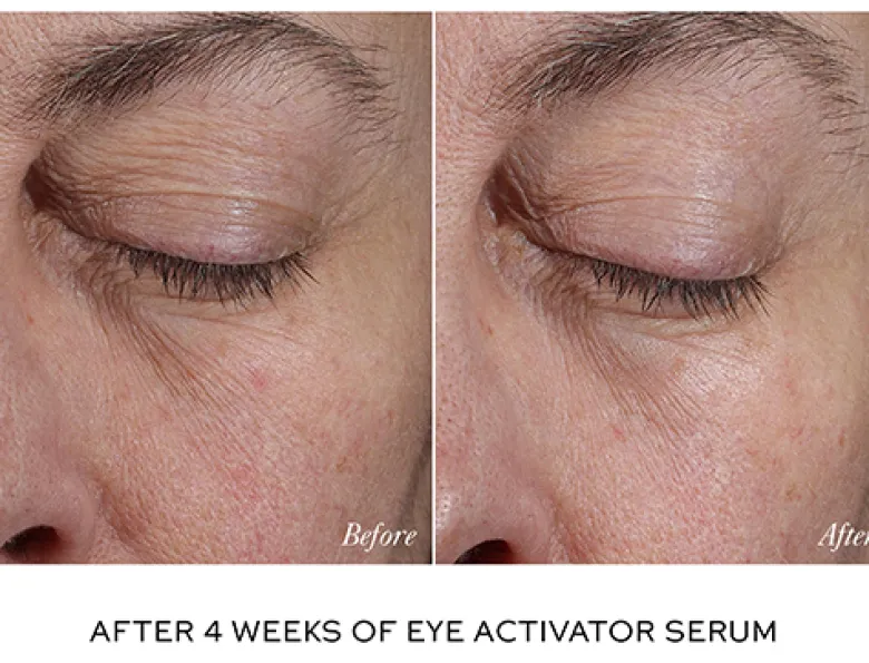 Activator Duo