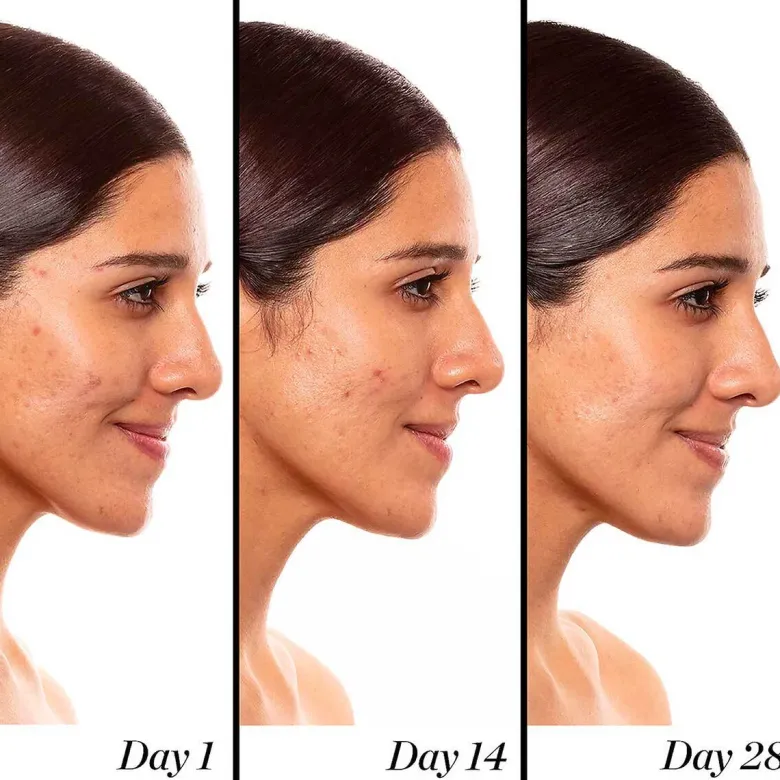 A+ High-Dose Retinoid Serum