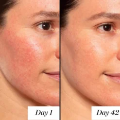 A+ High-Dose Retinoid Serum