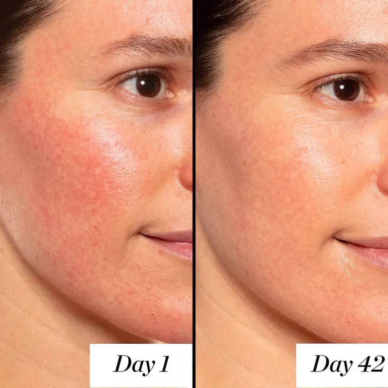 A+ High-Dose Retinoid Serum