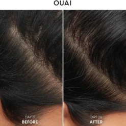 ANTI-DANDRUFF SHAMPOO