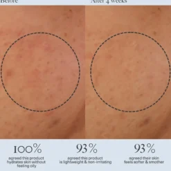 Barrier Repair Gel Cream