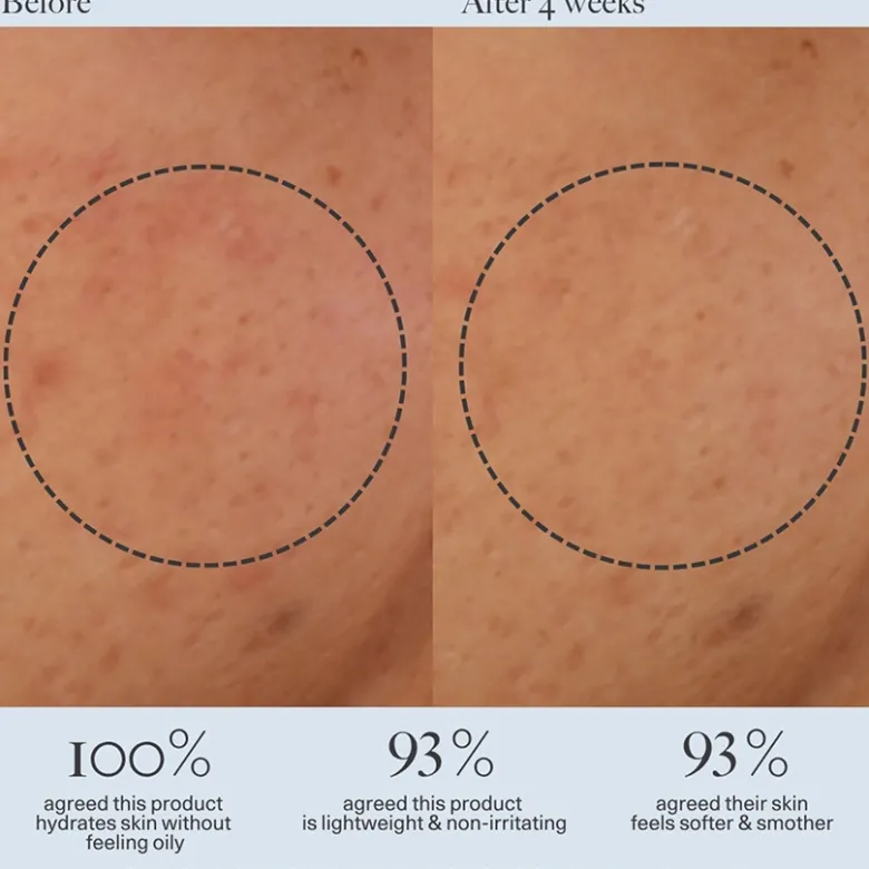 Barrier Repair Gel Cream