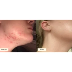 Beauty Formula Capsules
