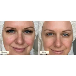 Beauty Formula 30 Day