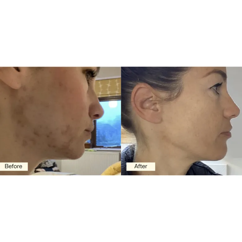 Beauty Formula 30 Day