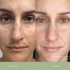 BIOCELL CORRECTING SERUM
