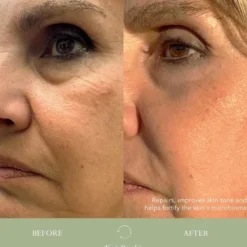 Bio-Correcting Face Cream