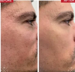 Booster Serum