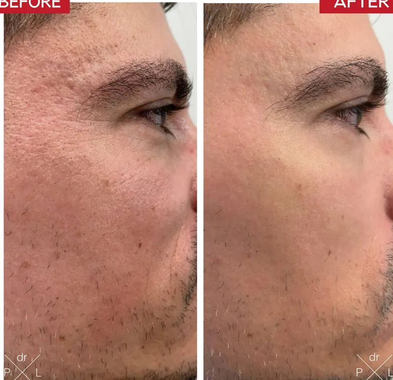Booster Serum