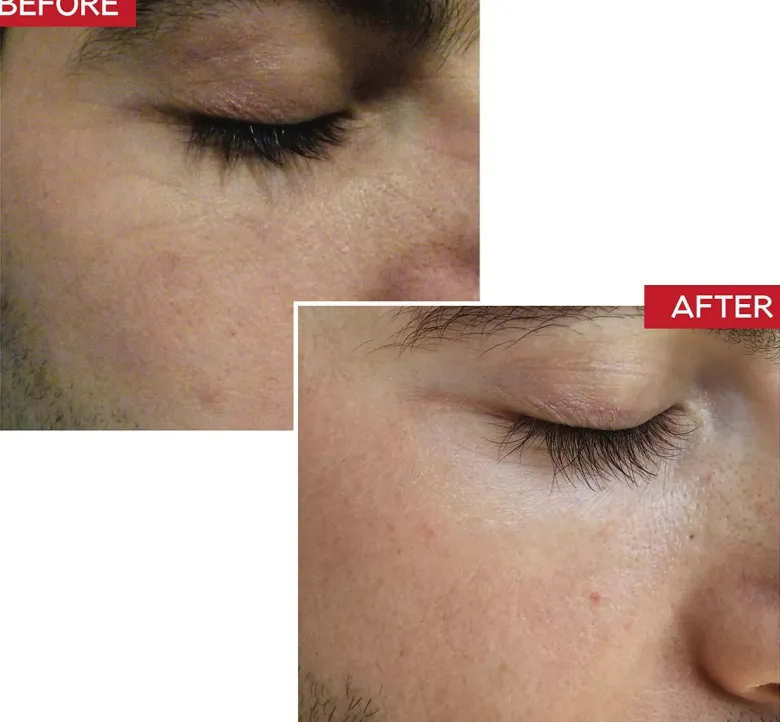 Booster Serum