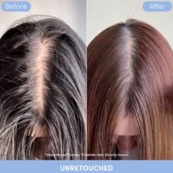Boost Therapy Hair Density Scalp Serum