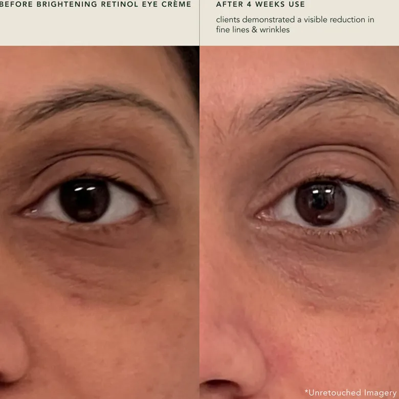 Brightening Retinol Eye Crème