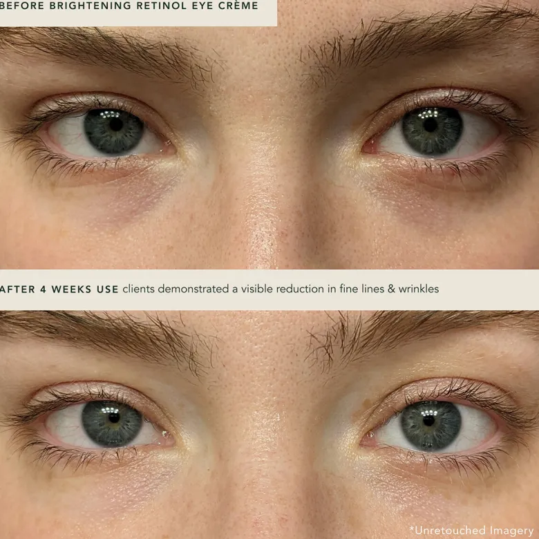 Brightening Retinol Eye Crème