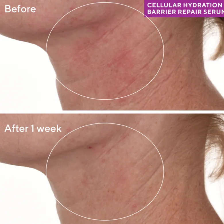 CELLULAR HYDRATION REPAIR SERUM