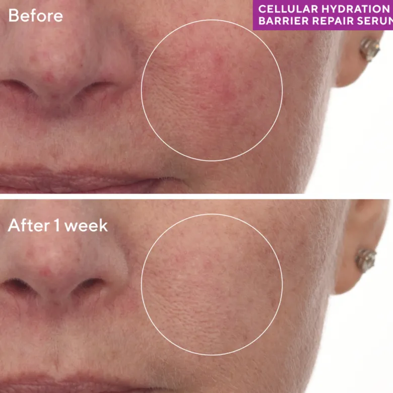 CELLULAR HYDRATION REPAIR SERUM