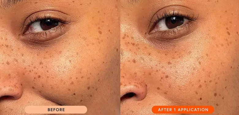 Ceramide Drops (Face Oil)