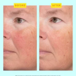 C-LUMA HYDRABRIGHT SERUM