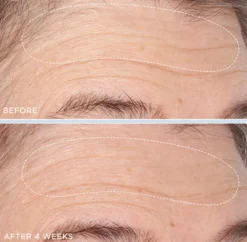 Cold Plasma Plus+ Advanced Hydrating Complex