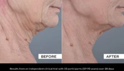 Collagen Solution Firming Serum for Face and Neck