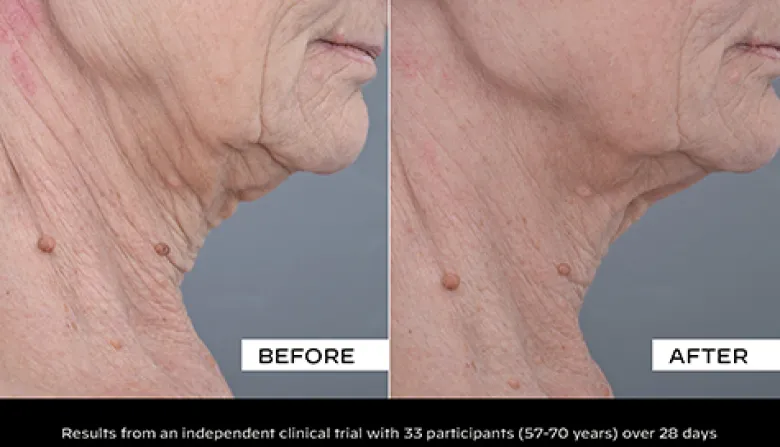 Collagen Solution Firming Serum for Face and Neck