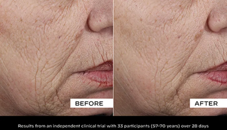 Collagen Solution Firming Serum for Face and Neck
