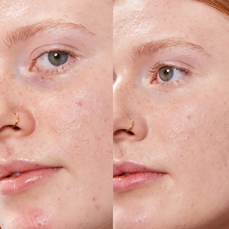 Concealer Balm