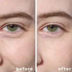 Cooling Hydrogel Under Eye Patches
