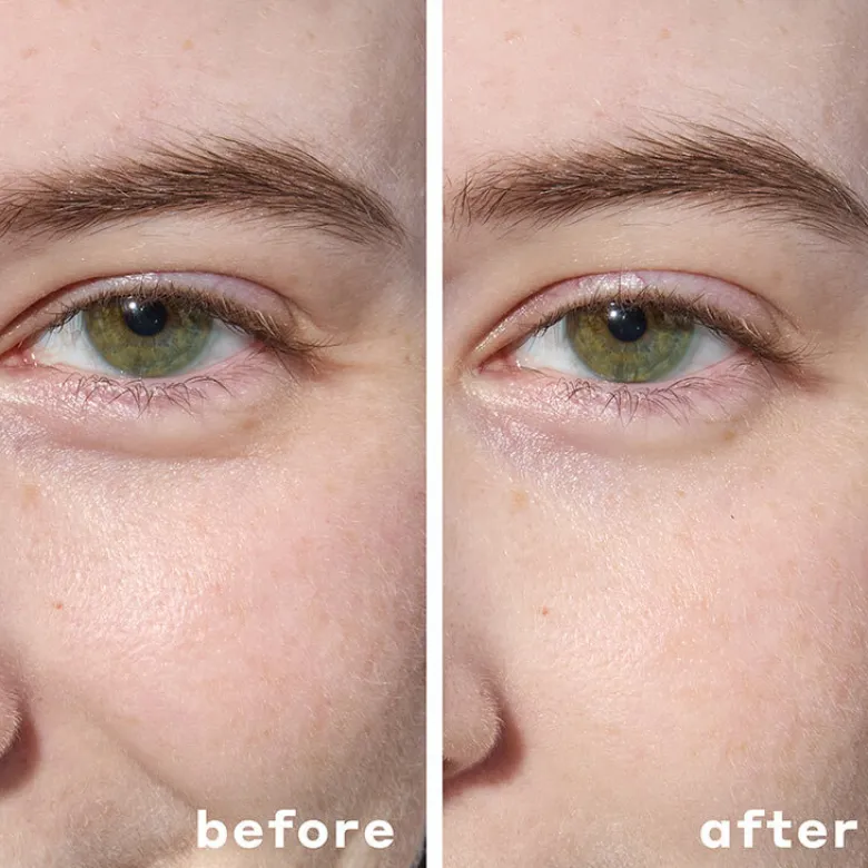Cooling Hydrogel Under Eye Patches