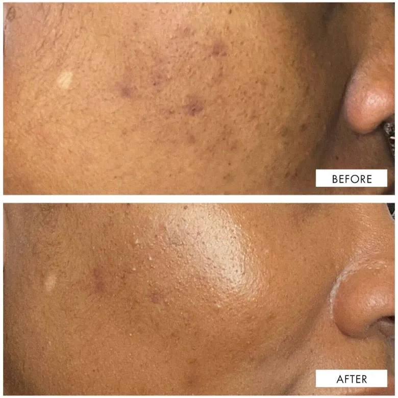 Dark Spot Correcting Serum