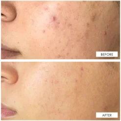 Dark Spot Correcting Serum