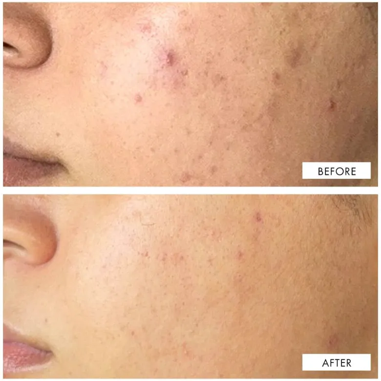 Dark Spot Correcting Serum