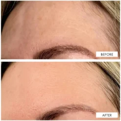 Dark Spot Correcting Serum