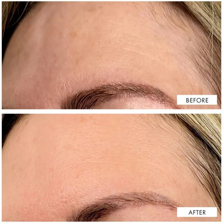 Dark Spot Correcting Serum