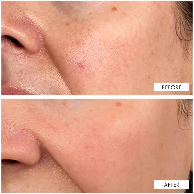 Dark Spot Correcting Serum