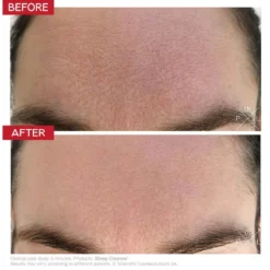 3Deep Micro-Resurfacing Cell Renewal Cleanser