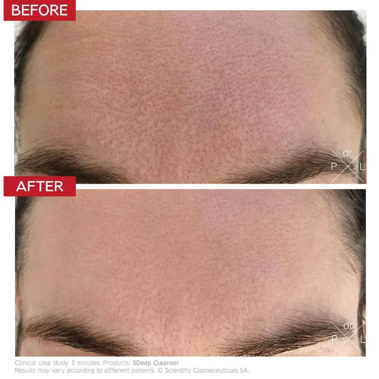 3Deep Micro-Resurfacing Cell Renewal Cleanser