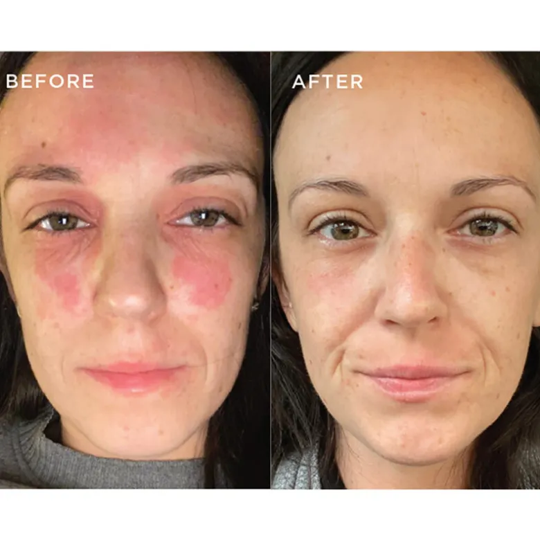 DERMA SKINCARE The Facial Cleanser