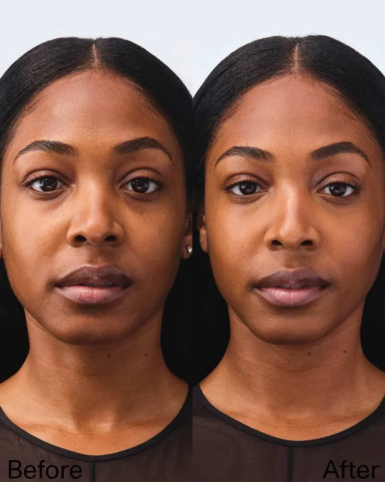 ESSENTIAL FACE COMPACT