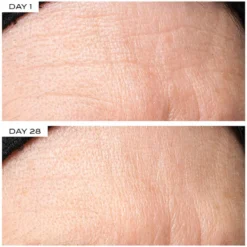 Exosome At-Home Face Lift Protocol
