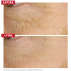 Eye Booster Concentrate