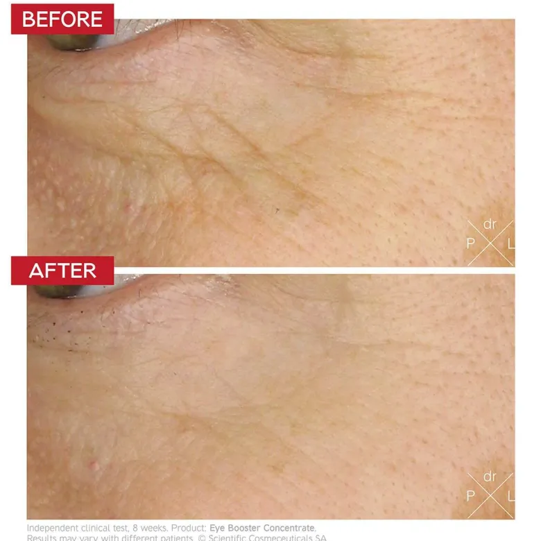 Eye Booster Concentrate