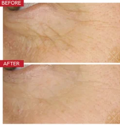 Eye Booster Concentrate