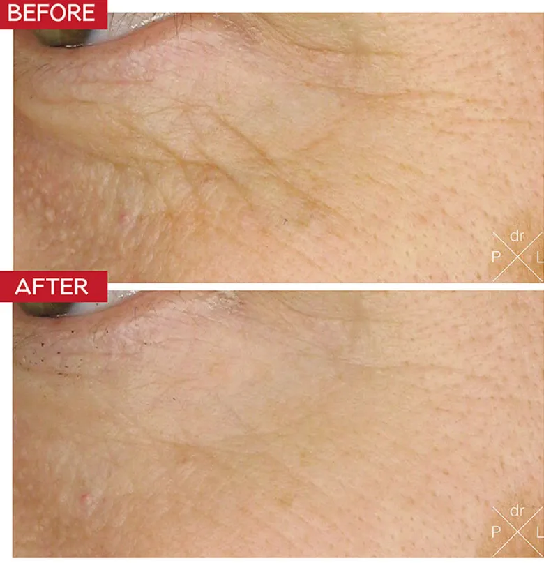 Eye Booster Concentrate