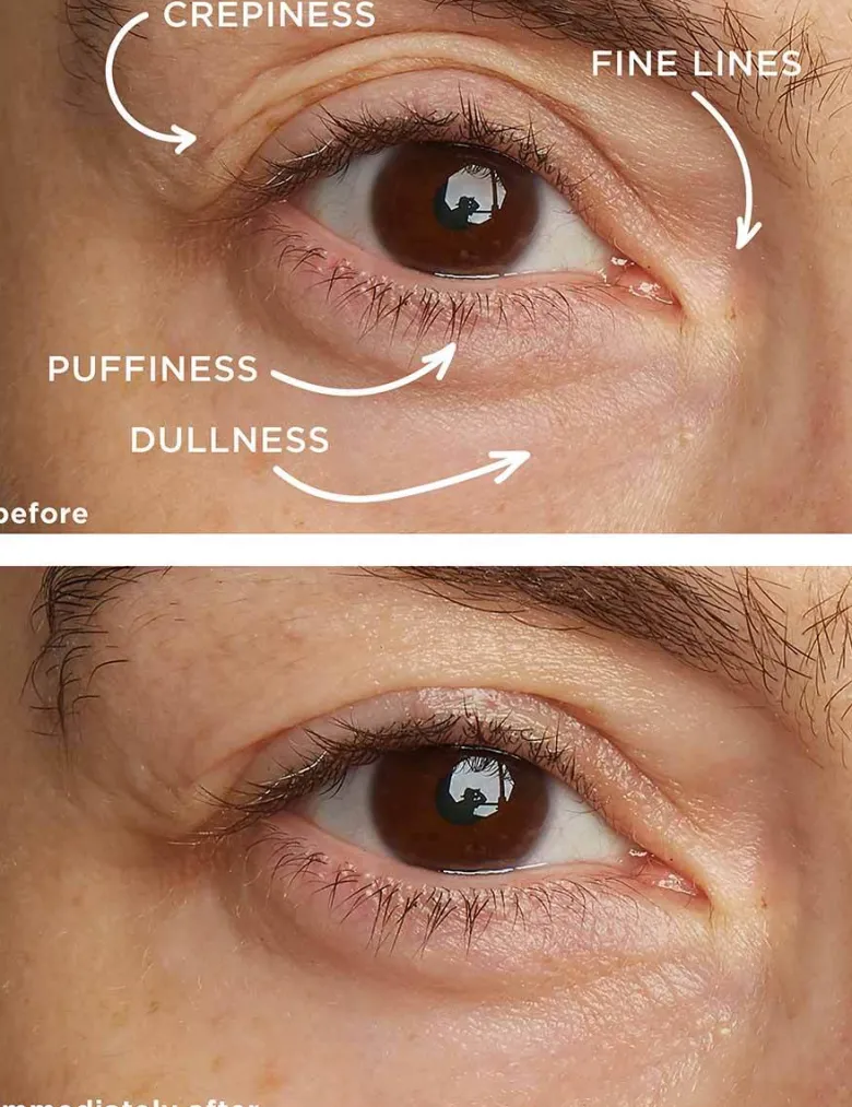 Eye Contour Lifting Cream