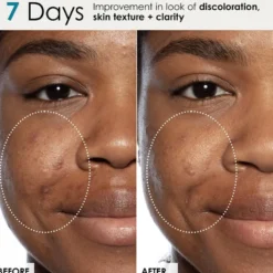 Good Genes Lactic Acid Treatment