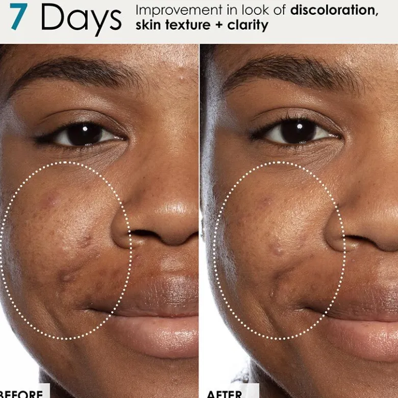 Good Genes Lactic Acid Treatment