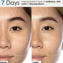 Good Genes Lactic Acid Treatment