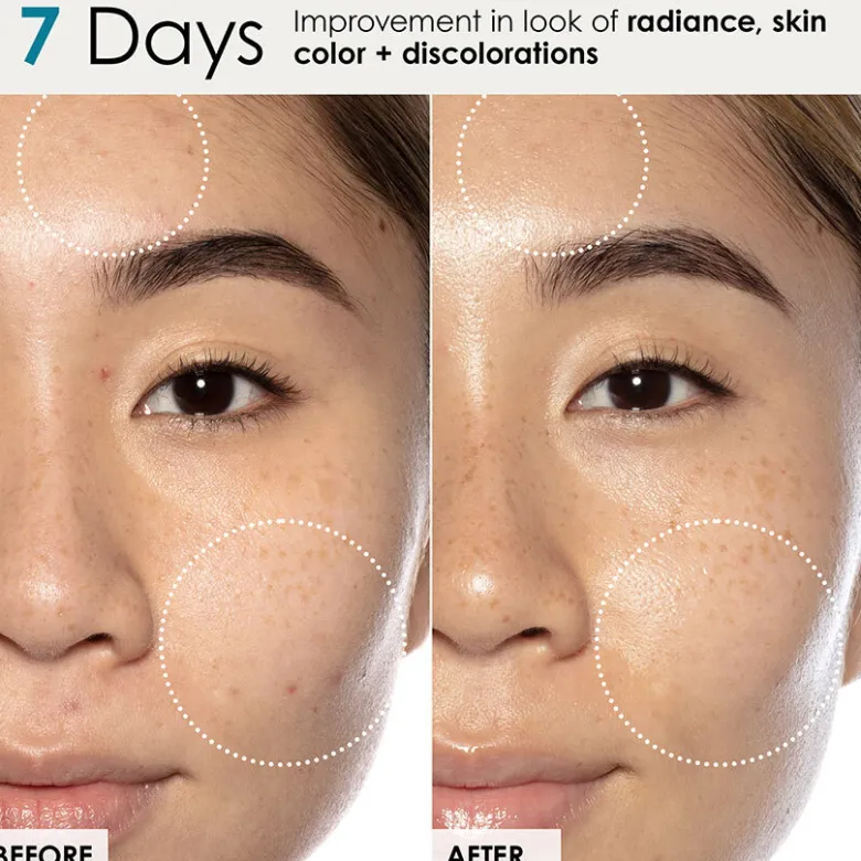 Good Genes Lactic Acid Treatment